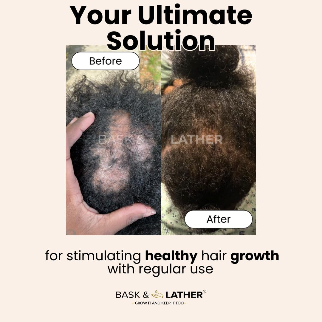 Scalp Stimulator Hair Growth Oil, Cold Pressed Mint and Rosemary Blend with Grapeseed for Hair Growth, Organic Natural Leave In, All Hair Types, 2 Fl Oz